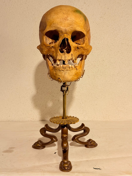 Originalt antikt menneske kranie, med 18K guldtand og udstillingsstativ. (Cranium homo sapiens)