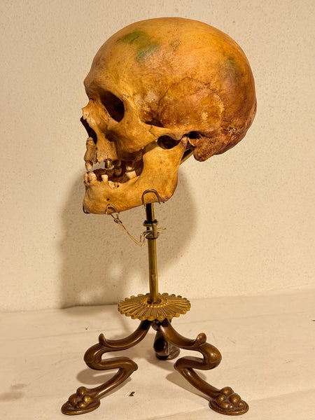 Originalt antikt menneske kranie, med 18K guldtand og udstillingsstativ. (Cranium homo sapiens)