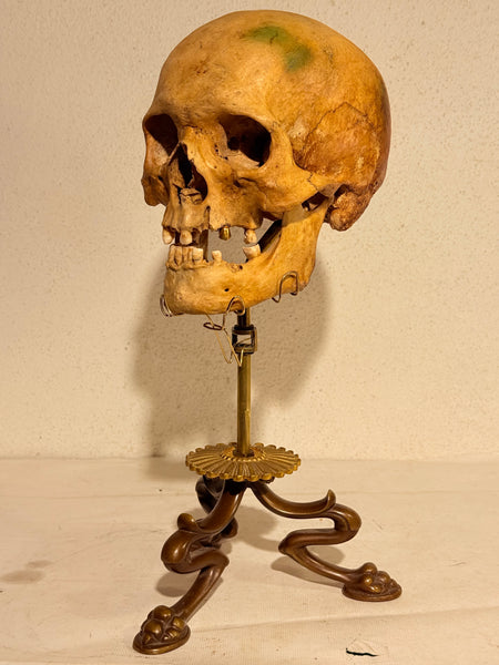 Originalt antikt menneske kranie, med 18K guldtand og udstillingsstativ. (Cranium homo sapiens)