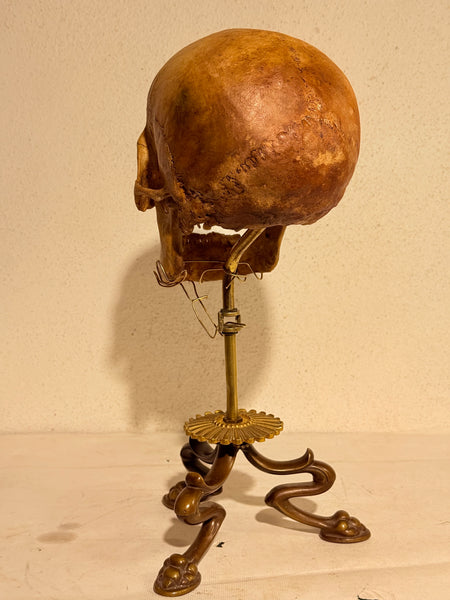 Originalt antikt menneske kranie, med 18K guldtand og udstillingsstativ. (Cranium homo sapiens)