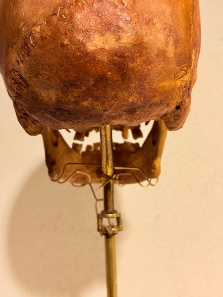 Originalt antikt menneske kranie, med 18K guldtand og udstillingsstativ. (Cranium homo sapiens)