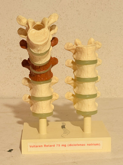 Vintage Ciba anatomisk ryghvirvel model